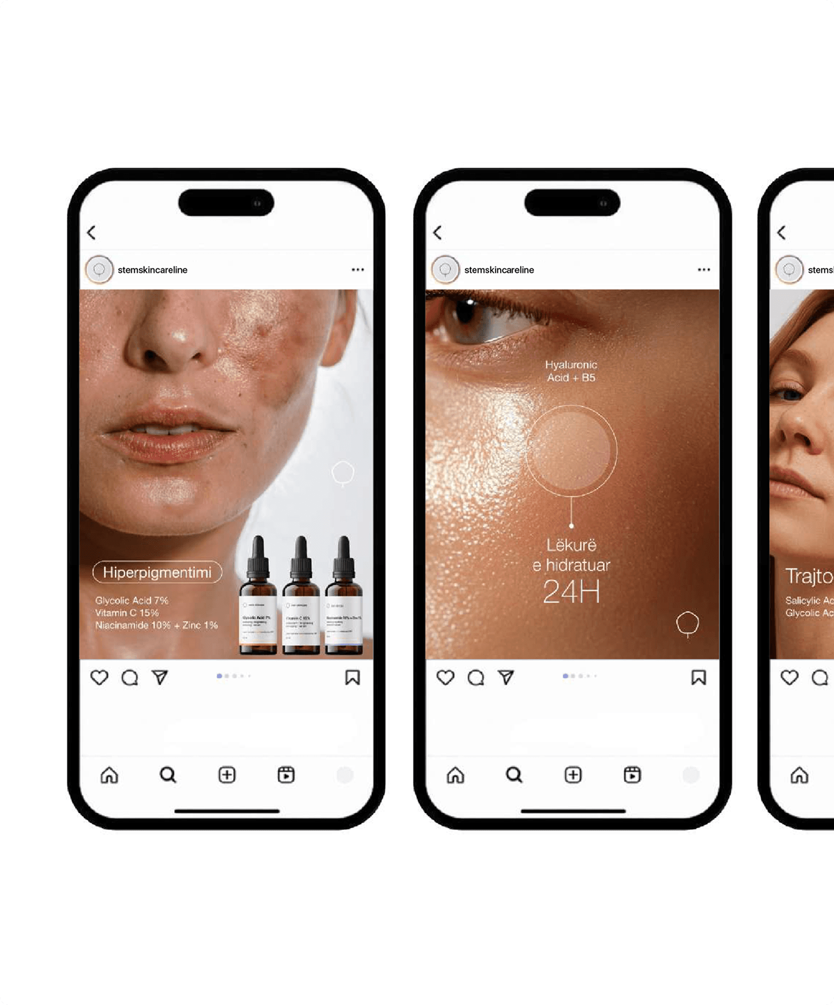 Three Instagram carousel slides showing close-up skin photography with ingredient overlays in Albanian.